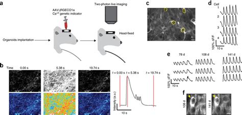 Two-photon imaging reveals neuronal activity in the graft (a)... | Download Scientific Diagram