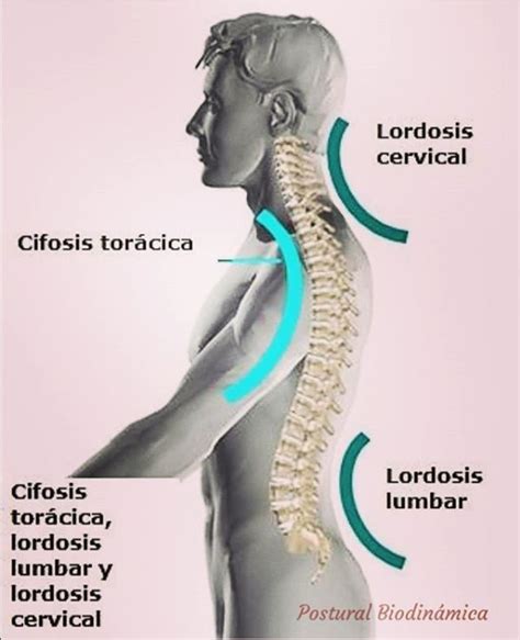 Tipos de cifosis #espalda #cifosis #lordosis #anatomia | Spine health ...