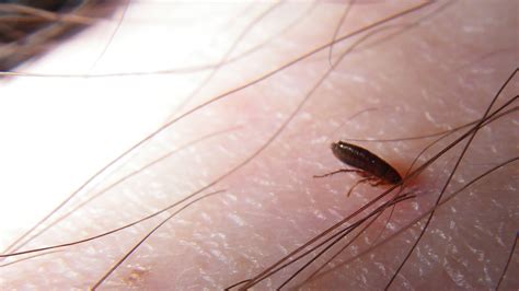 Flea and Tick in Singapore | Flea, Tick & Pest Control in Singapore | top-pestcontrol.sg