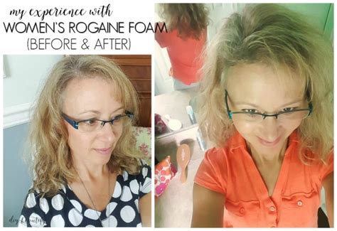 Women's Hair Loss (and My Experience With ROGAINE® Foam) | DIY beautify