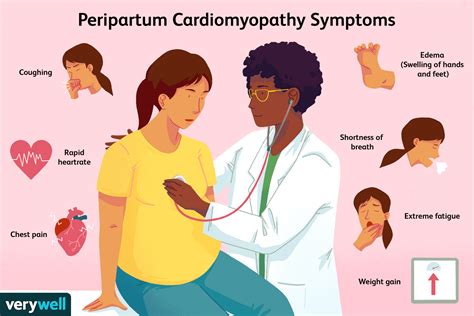 Cardiomiopatia Periparto: Sintomas, Diagnóstico E Tratamento | 2024