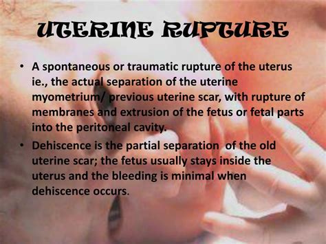 PPT - UTERINE RUPTURE PowerPoint Presentation, free download - ID:506056