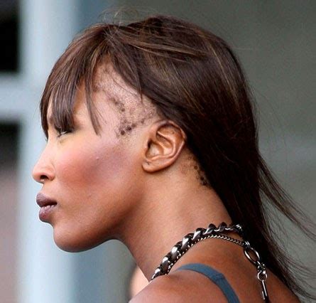 Naomi Campbell's Hairline Tells The World To STFU