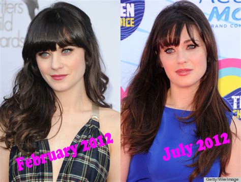 Zooey Deschanel Botox