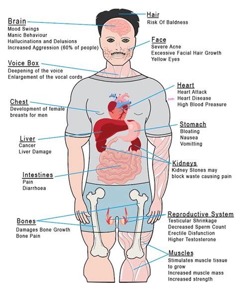 Steroid Side Effect Diagram :: Behance