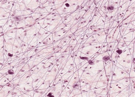 Areolar Connective Tissue Histology