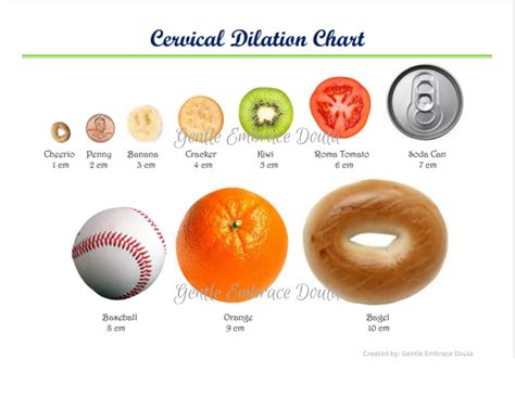 Cervical Dilation Chart Soft/hard cervix vs effaced