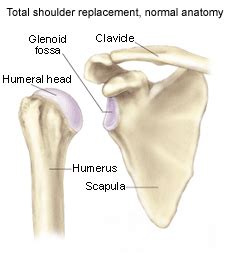 Glenohumeral Arthritis