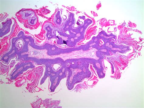 Pathology Outlines Histology