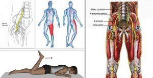 Lombocruralgia: guida avanzata. Sintomi ,diagnosi e cura | Ryakos Center