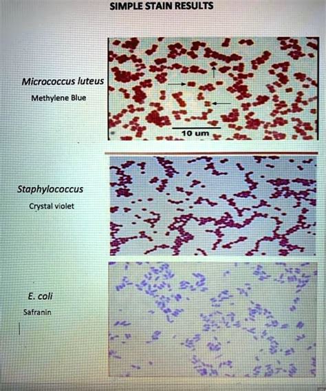 SIMPLE STAIN RESULTS Micrococcus luteus Methylene Blue Staphylococcus Crystal Violet E. coli ...