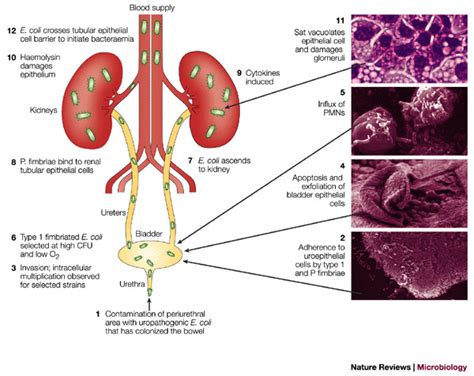 Infectious Microbes