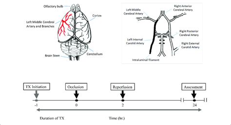 Middle Cerebral Artery Occlusion