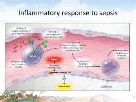 Septicemia