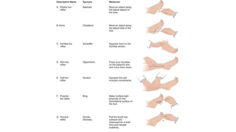 Plantar reflex