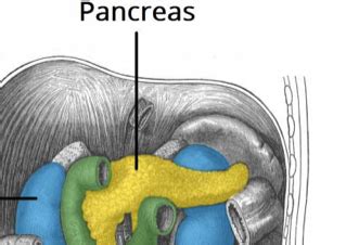 Acute Pancreatitis - Causes - Investigations - Management - TeachMeSurgery