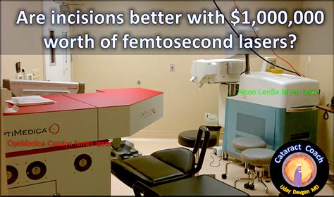 Femto Laser Incisions: Good or Bad? – Cataract Coach