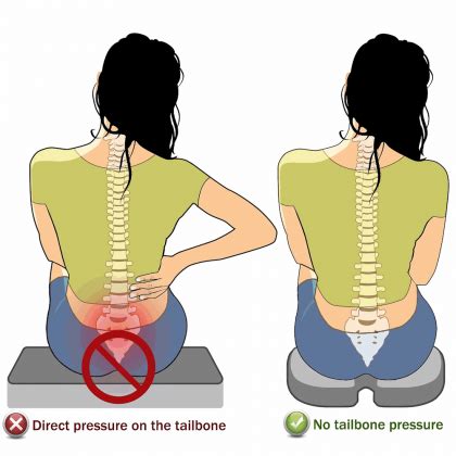 Tailbone Pain Treatment - The Best Remedy to Overcome Coccyx