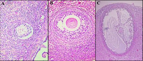 Figure 1 from Biostimulation methods associated with early weaning and reproductive rhythms in ...