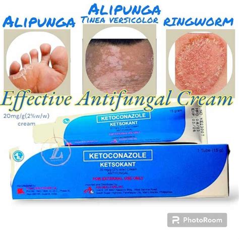 Effective AntiFungal Cream Ointment KETSOKANT Ketoconazole for Anan Buni Alipunga hadhad ...