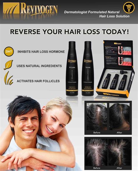 Dermatologist Formulated Natural Hair loss Solution | Hair loss solutions, Natural hair loss ...