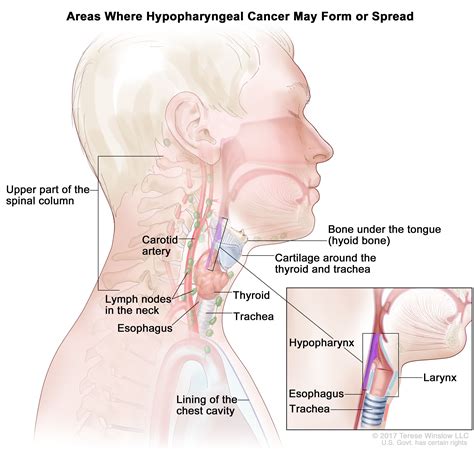 Hypopharyngeal Cancer Treatment - NCI