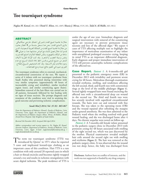 (PDF) Toe tourniquet syndrome