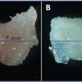 The appearance of cell pseudopod formation with scanning (A) and... | Download High-Quality ...