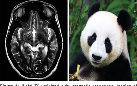 Figure 1 from The face of the giant panda: Demystified | Semantic Scholar