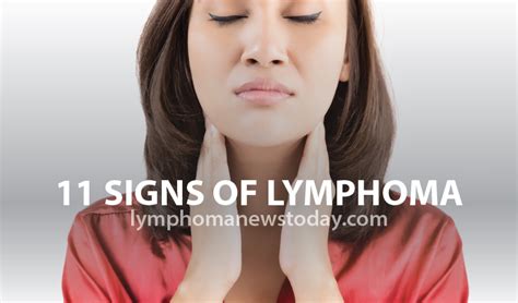 Early stage cancer lymph nodes in neck - jordentertainment