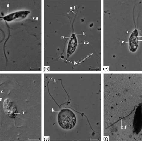 Morphology of the flagellated cells, the amoeboid cells and the cysts... | Download Scientific ...