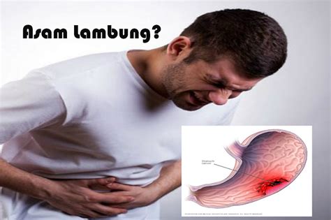 Pengertian Penyakit Asam Lambung, Gejala, Penyebab, Diagnosis dan Cara Pengobatannya - Guruupdates