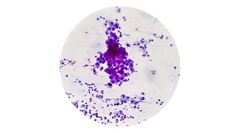 Fibrosarcoma In Dogs: Symptoms, Diagnosis, Treatment & Prognosis - Petsynse