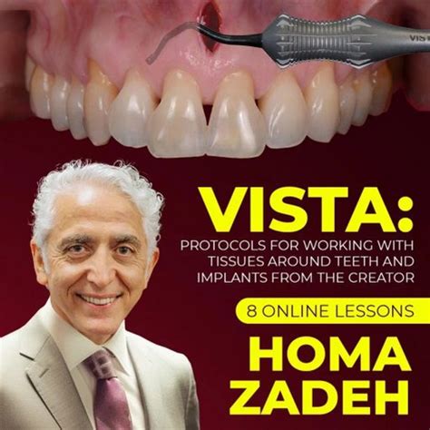 VISTA Technique: Protocols for Working with Tissues Around Teeth and ...