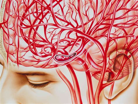 Blood Vessels That Can Be Affected by a Stroke