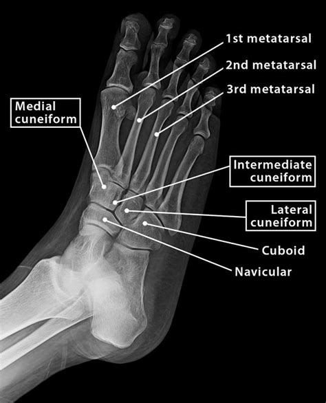 Cuneiform Bones - Definition, Location, Anatomy, & Diagrams