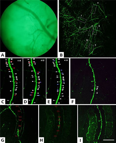 Two-photon imaging of mouse brain neurons in living mice. (Bars: A =... | Download Scientific ...