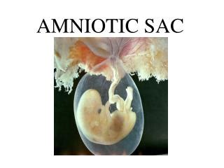 PPT - Structure and function of the placenta and amniotic sac PowerPoint Presentation - ID:1070638