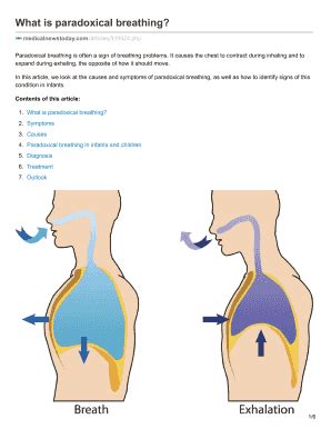 What Is Paradoxical Breathing - Fill and Sign Printable Template Online