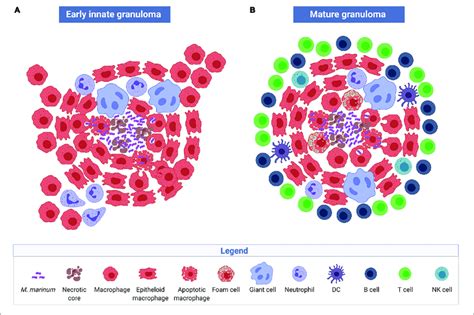 | Structure and cellular composition of granulomas. Early innate M ...