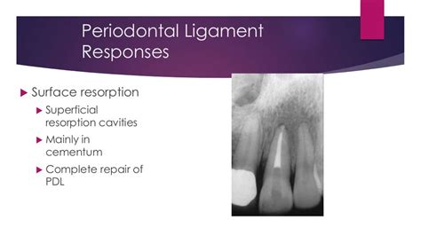 Luxation tooth injuries