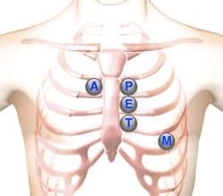 Fundamentals of Heart Sounds