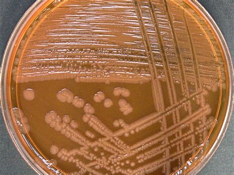 Proteus mirabilis | Proteus mirabilis, Microbiology, Microbiology lab