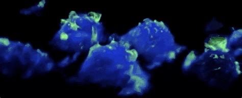 Amazing video shows how white blood cells find pathogens -- and points to a cure against cancer