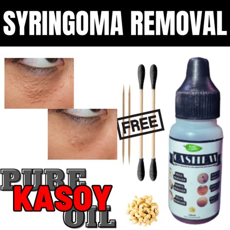 SYRINGOMA REMOVAL CASHEW OIL , syringoma remover original , syringoma ...