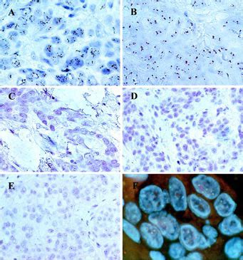 Chromogenic In Situ Hybridization: A Novel Approach to a Practical and ...