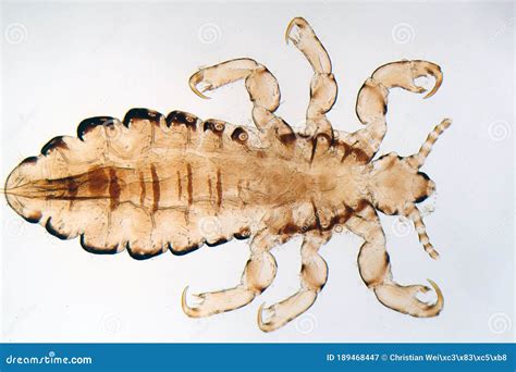 Head Louse, Pediculus Humanus, Under the Microscope Stock Image - Image ...