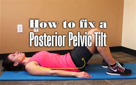 Best Exercises to Fix Your Posterior Pelvic Tilt - Your Body Posture