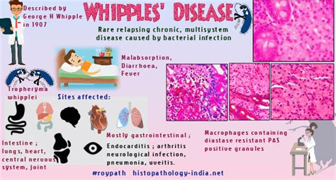 Pathology of Whipple's Disease - Dr Sampurna Roy MD