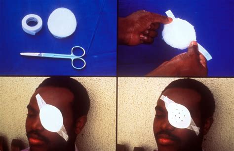 How to apply an eye pad | Top left picture: Adhesive tape; e… | Flickr